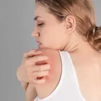woman scratching her back that has prickly heat rash